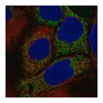 Merck Anti-HKDC1 antibody produced in rabbit