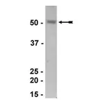 Merck Anti-Estrogen-related Receptor α Antibody