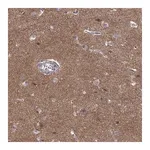 Merck Anti-STRC antibody produced in rabbit