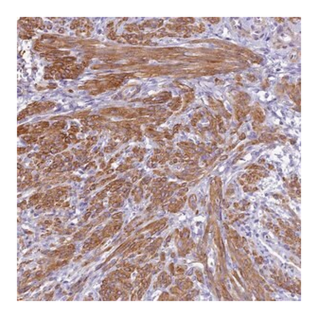 Merck Anti-FBXW4 antibody produced in rabbit