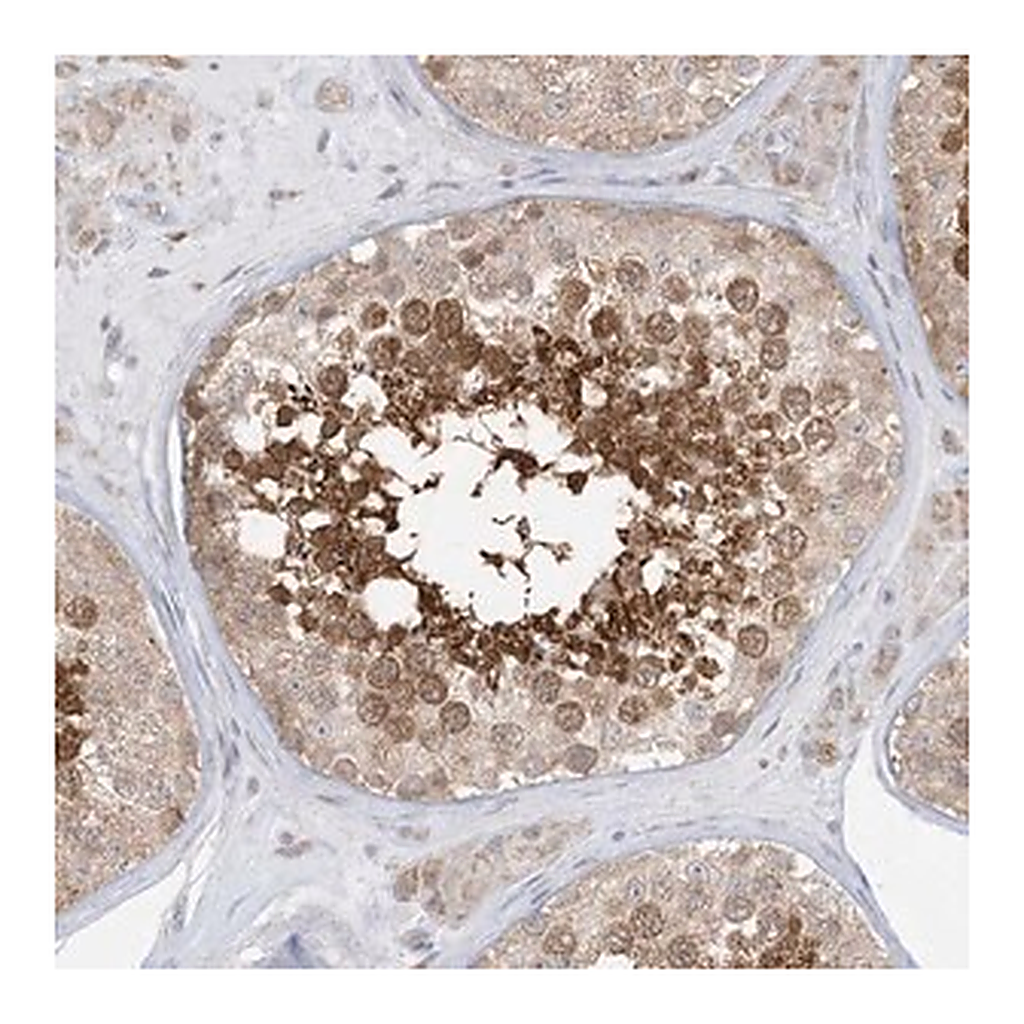 Merck Anti-KANSL3 antibody produced in rabbit