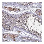 Merck Anti-TK2 antibody produced in rabbit