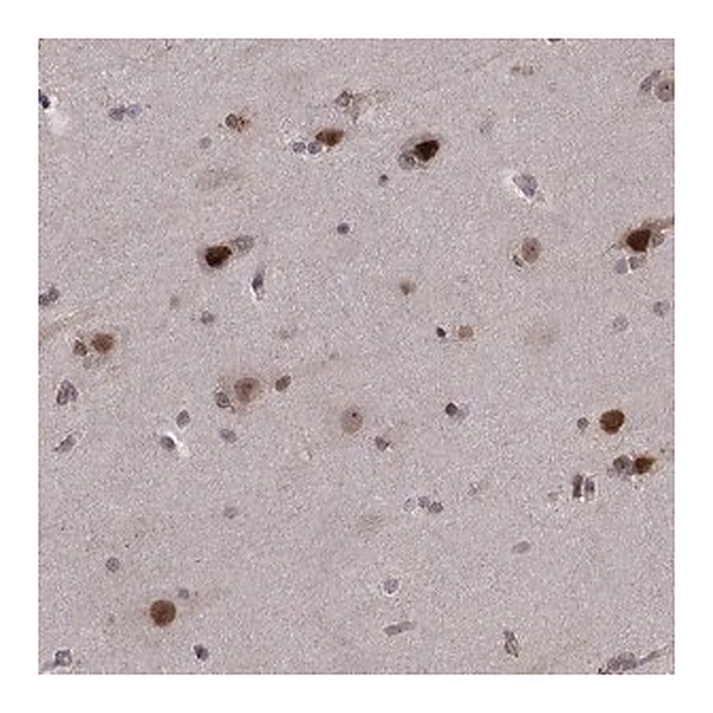 Merck Anti-PSMC2 antibody produced in rabbit