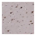 Merck Anti-PSMC2 antibody produced in rabbit