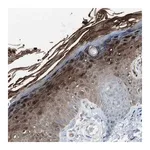 Merck Anti-S100A7 antibody produced in rabbit