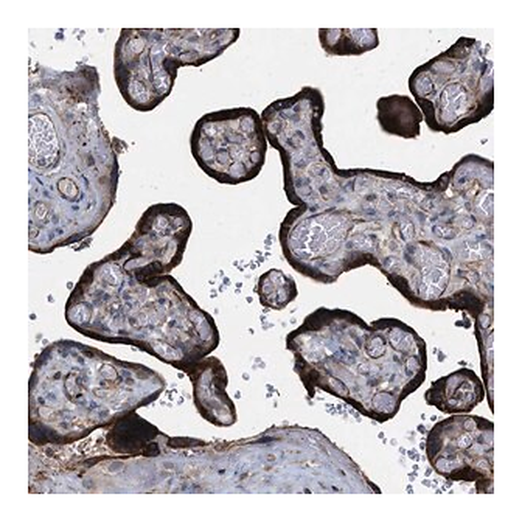 Merck Anti-TMEM131 antibody produced in rabbit