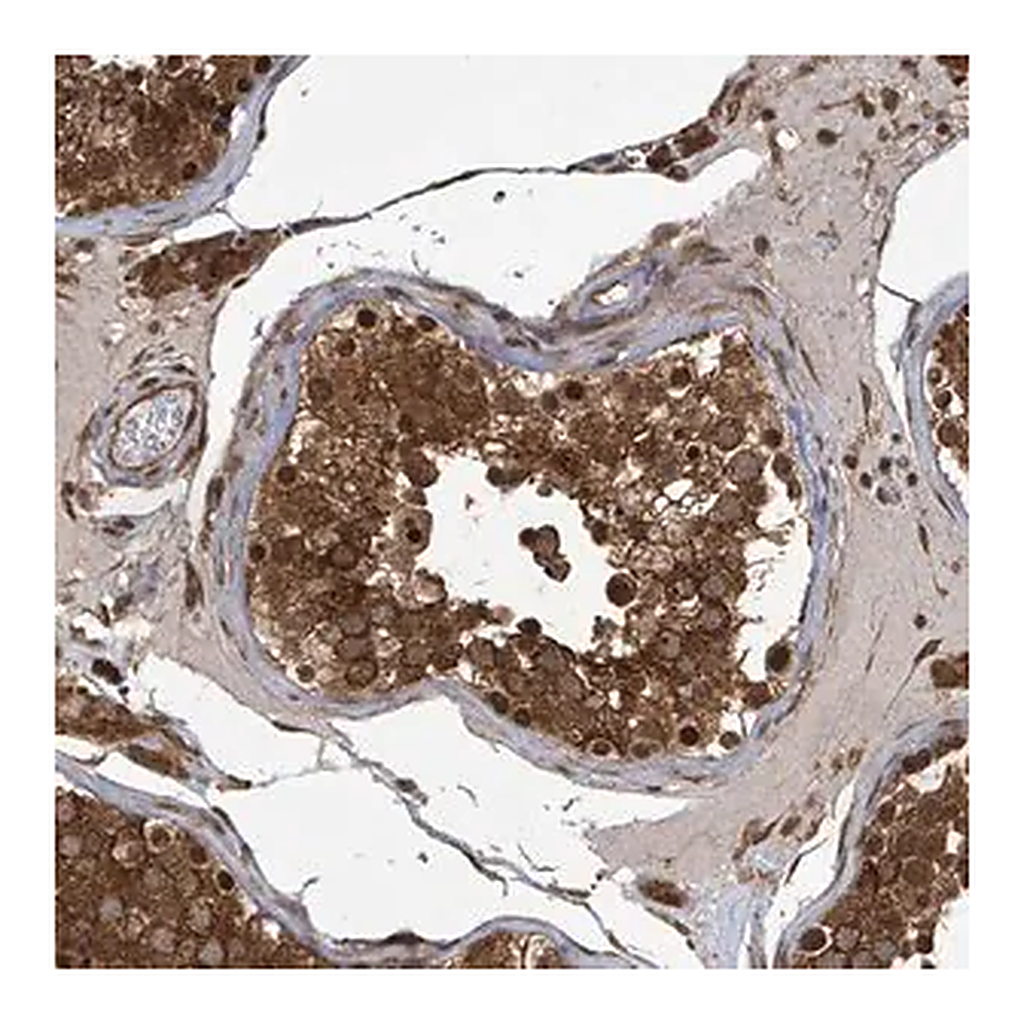 Merck Anti-KLC1 antibody produced in rabbit