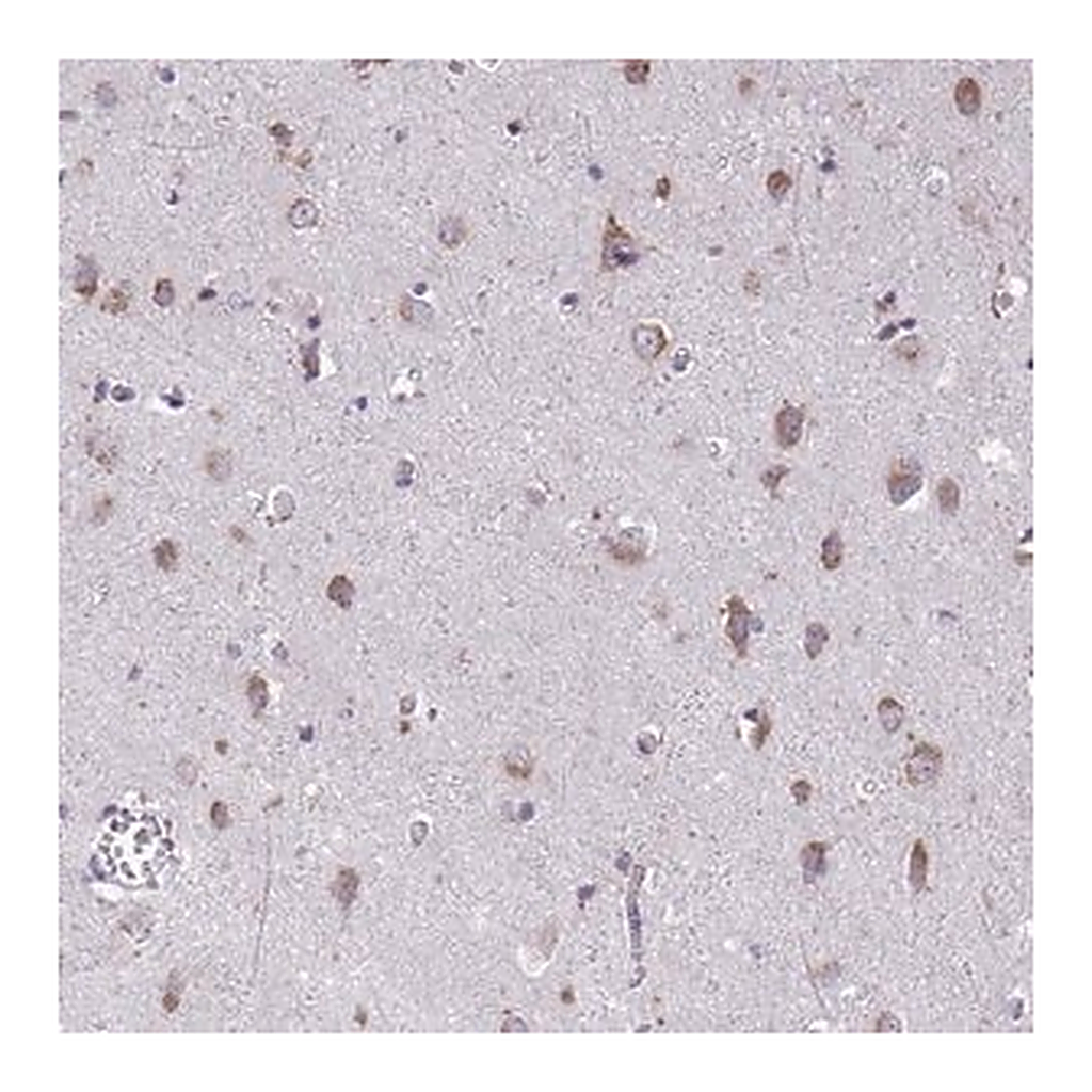 Merck Anti-TMEM106B antibody produced in rabbit