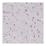 Merck Anti-TMEM106B antibody produced in rabbit