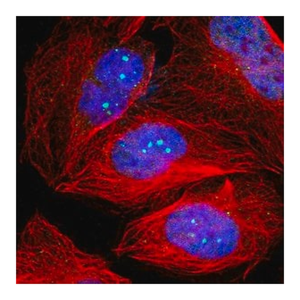 Merck Anti-TP53BP1 antibody produced in rabbit