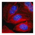 Merck Anti-TP53BP1 antibody produced in rabbit