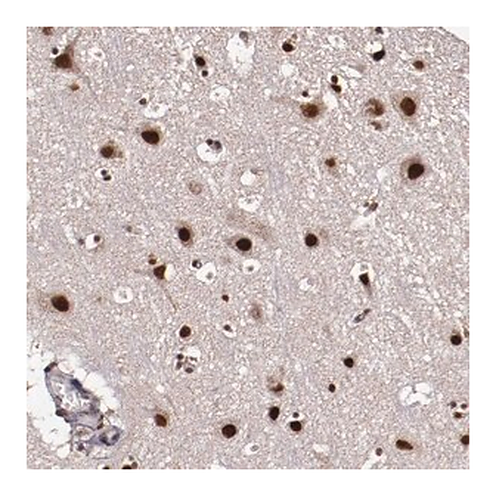 Merck Anti-CECR2 antibody produced in rabbit