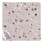 Merck Anti-CECR2 antibody produced in rabbit