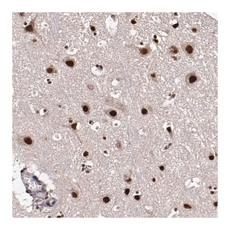 Merck Anti-CECR2 antibody produced in rabbit