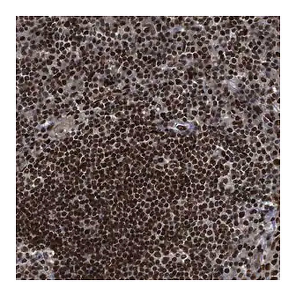 Merck Anti-RFX5 antibody produced in rabbit