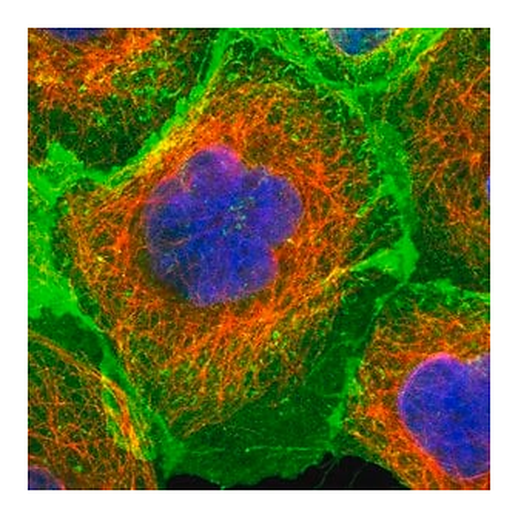 Merck Anti-ERBB2 antibody produced in rabbit