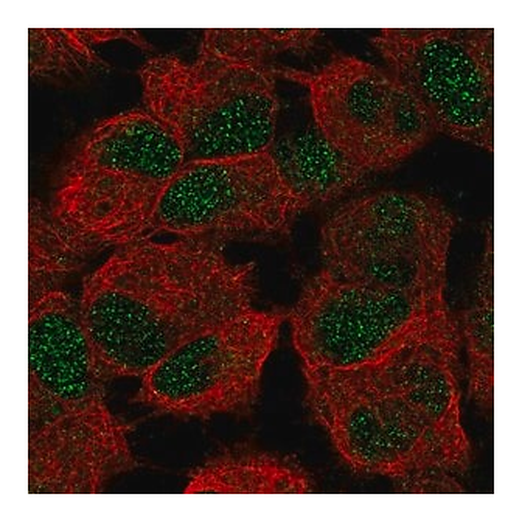 Merck Anti-CERS6 antibody produced in rabbit