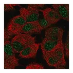 Merck Anti-CERS6 antibody produced in rabbit