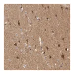 Merck Anti-KIF21B antibody produced in rabbit