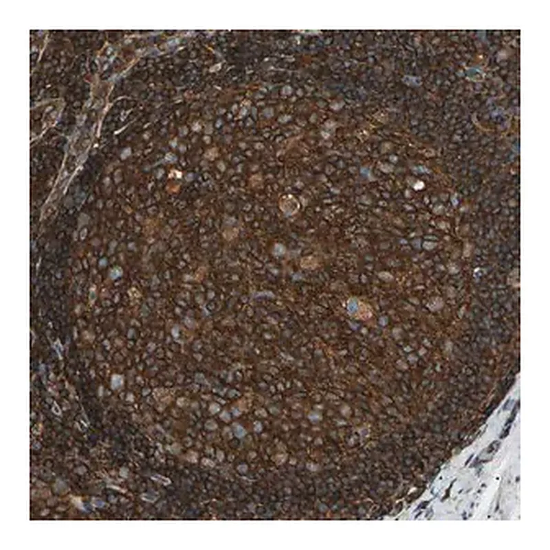 Merck Anti-ARPC2 antibody produced in rabbit