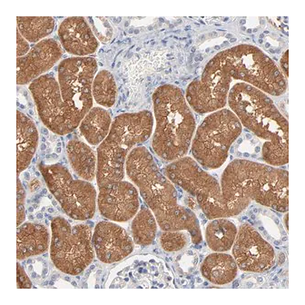 Merck Anti-ZDHHC8 antibody produced in rabbit