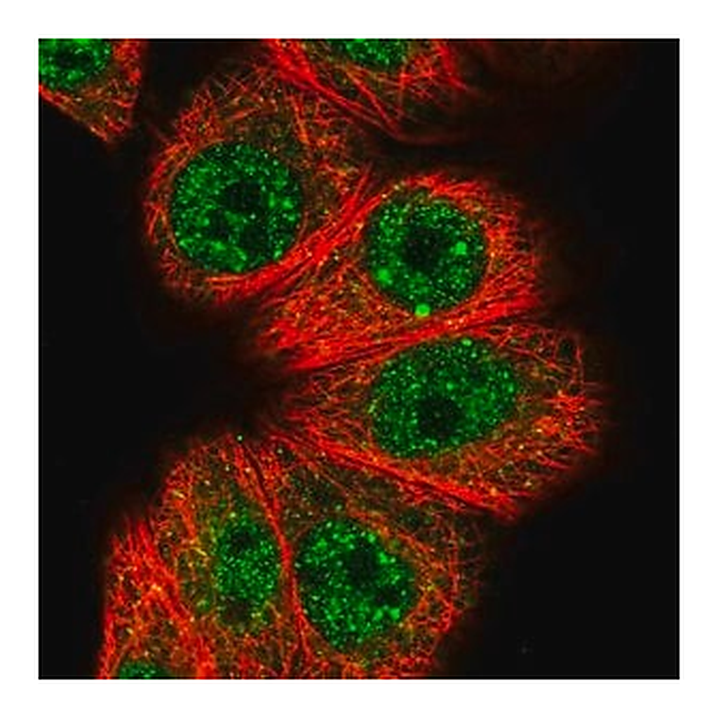 Merck Anti-HOXB7 antibody produced in rabbit
