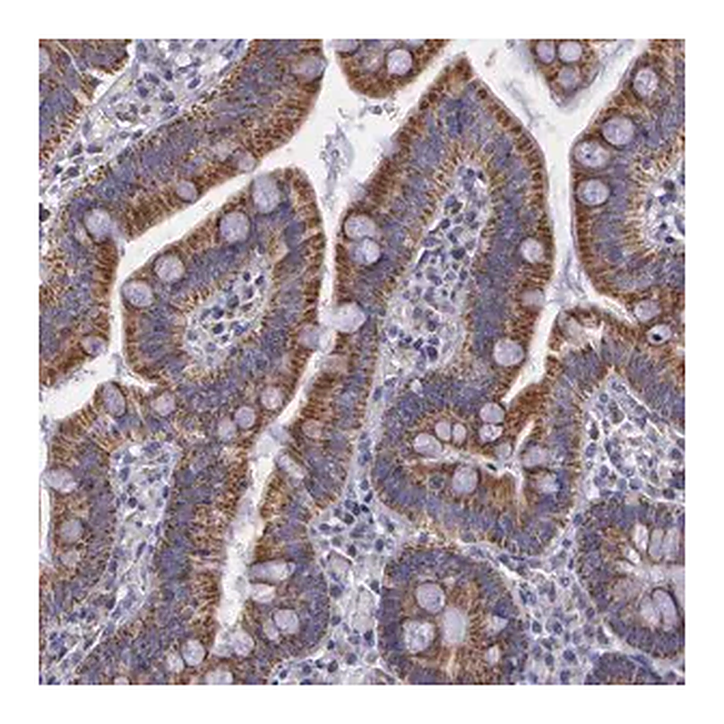 Merck Anti-SYNJ2BP antibody produced in rabbit