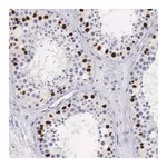 Merck Anti-HMGN5 antibody produced in rabbit