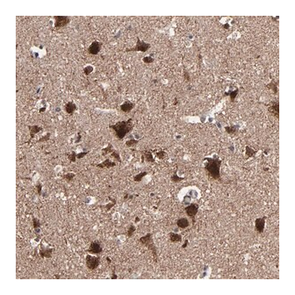 Merck Anti-BNIP3 antibody produced in rabbit