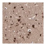 Merck Anti-BNIP3 antibody produced in rabbit