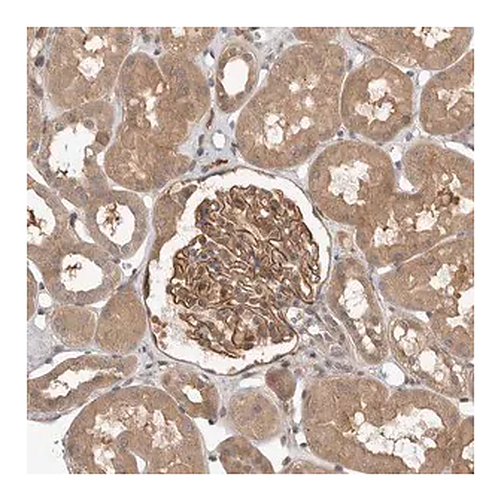 Merck Anti-OSBPL9 antibody produced in rabbit