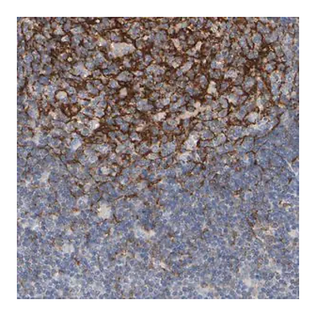 Merck Anti-EPHX2 antibody produced in rabbit