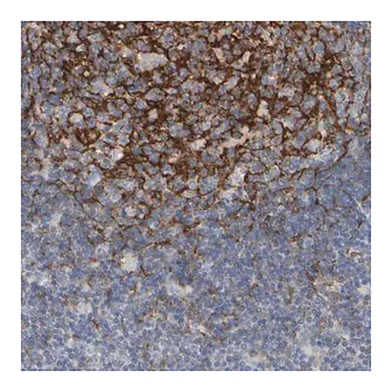 Merck Anti-EPHX2 antibody produced in rabbit