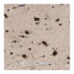 Merck Anti-LARP6 antibody produced in rabbit