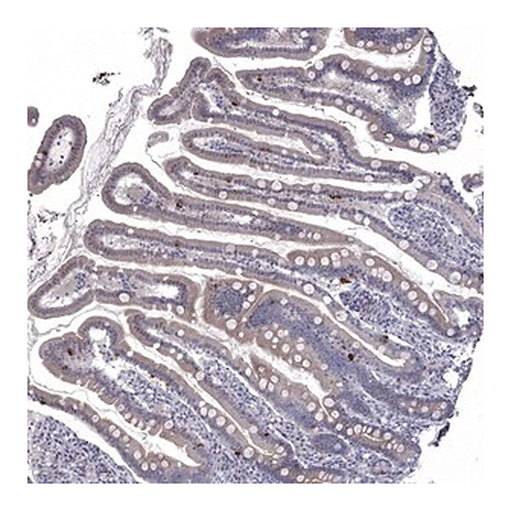 Merck Anti-NRARP antibody produced in rabbit