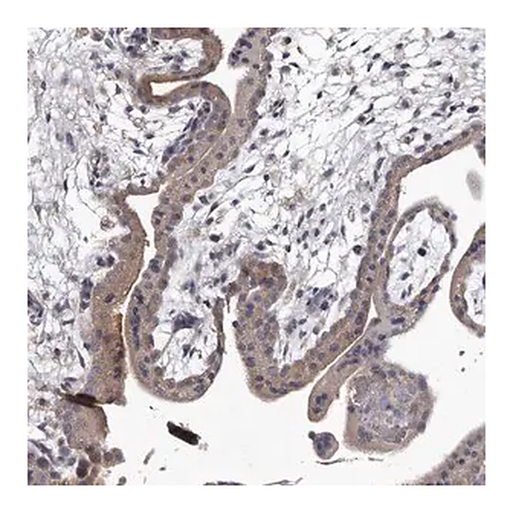 Merck Anti-GAPVD1 antibody produced in rabbit