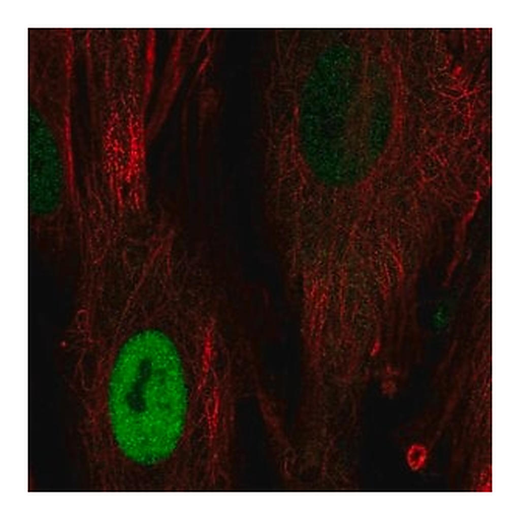 Merck Anti-CCND1 antibody produced in rabbit