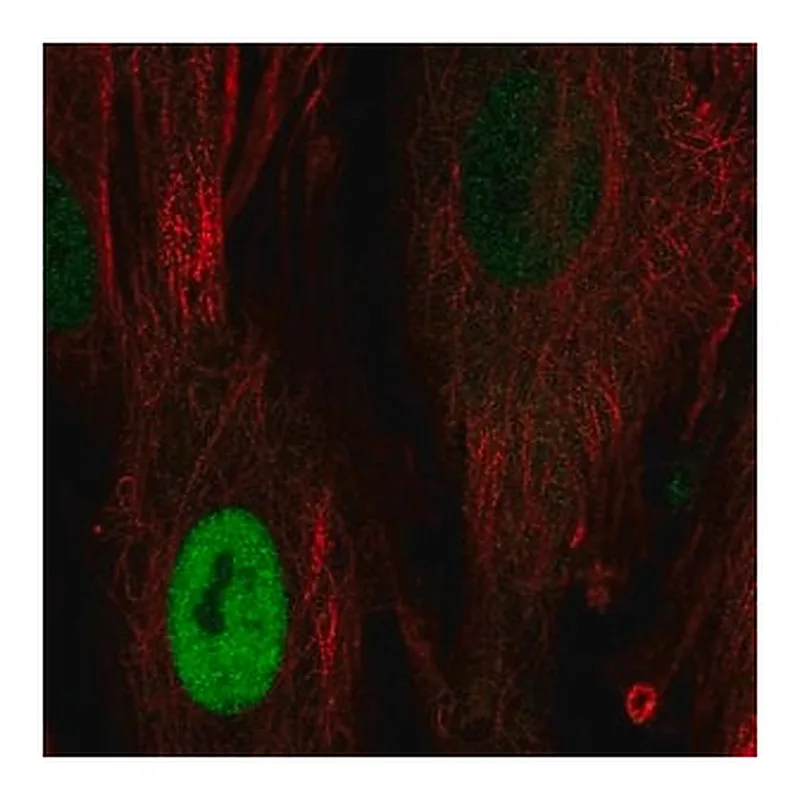 Merck Anti-CCND1 antibody produced in rabbit