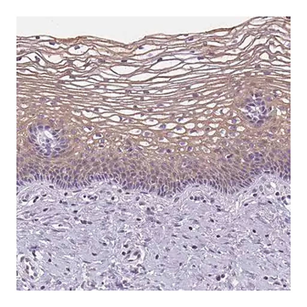 Merck Anti-GSDMC antibody produced in rabbit