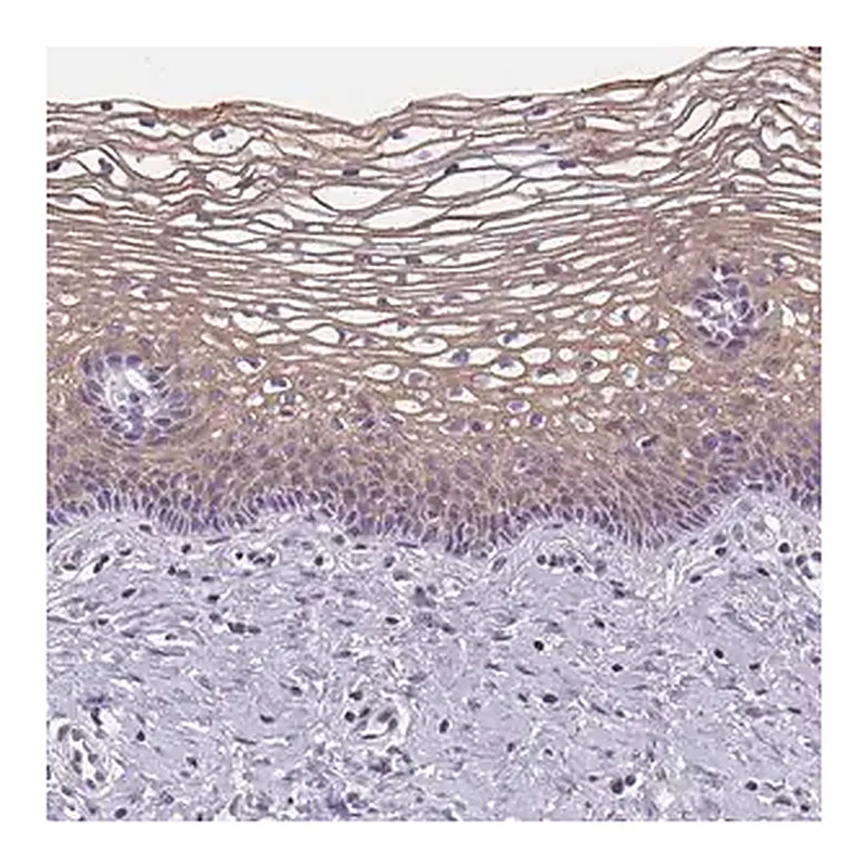 Merck Anti-GSDMC antibody produced in rabbit