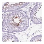 Merck Anti-OR7C1 antibody produced in rabbit