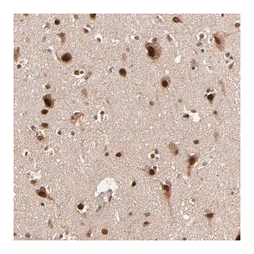 Merck Anti-TOP1MT antibody produced in rabbit