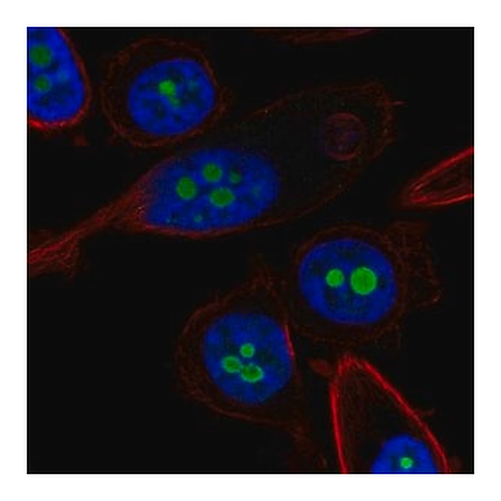 Merck Anti-CDKN2A antibody produced in rabbit