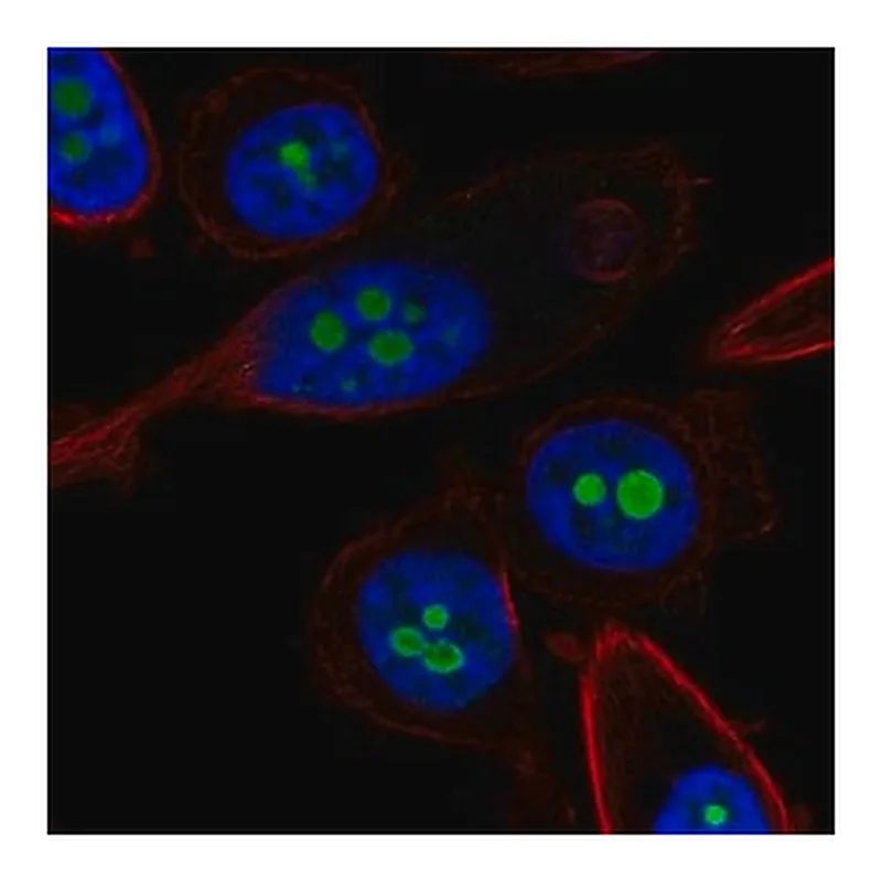 Merck Anti-CDKN2A antibody produced in rabbit