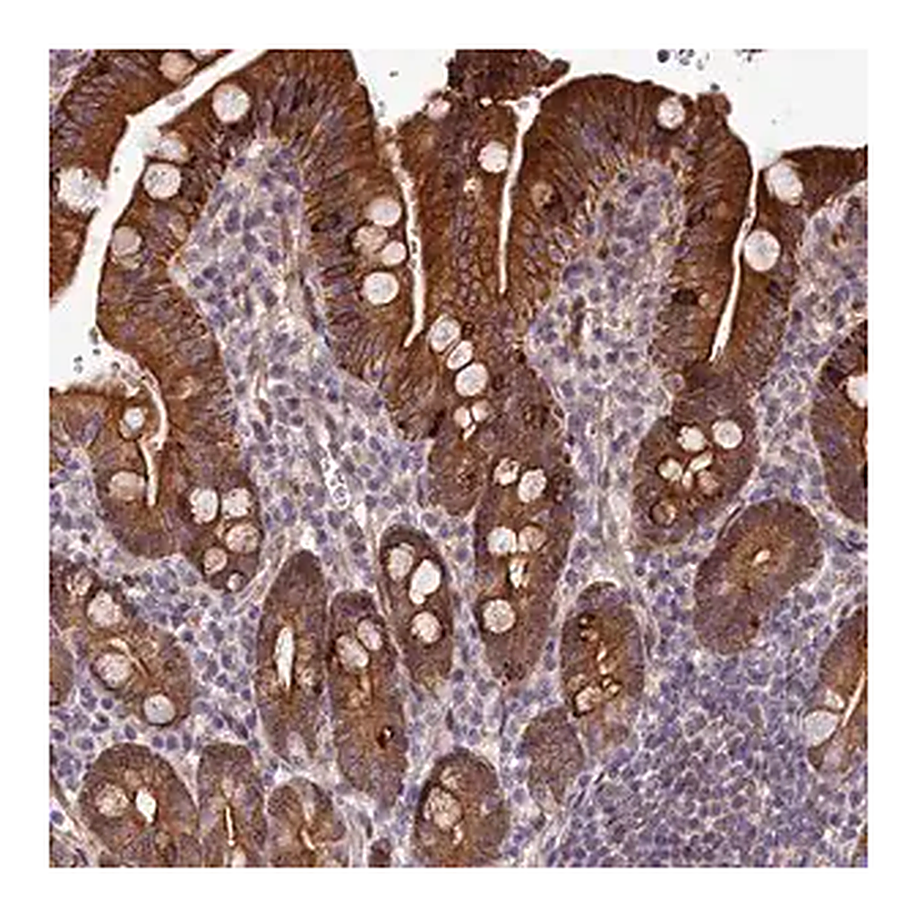 Merck Anti-ABCB8 antibody produced in rabbit