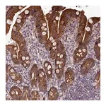 Merck Anti-ABCB8 antibody produced in rabbit