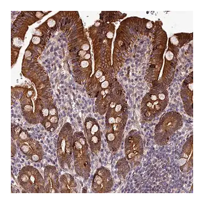 Merck Anti-ABCB8 antibody produced in rabbit
