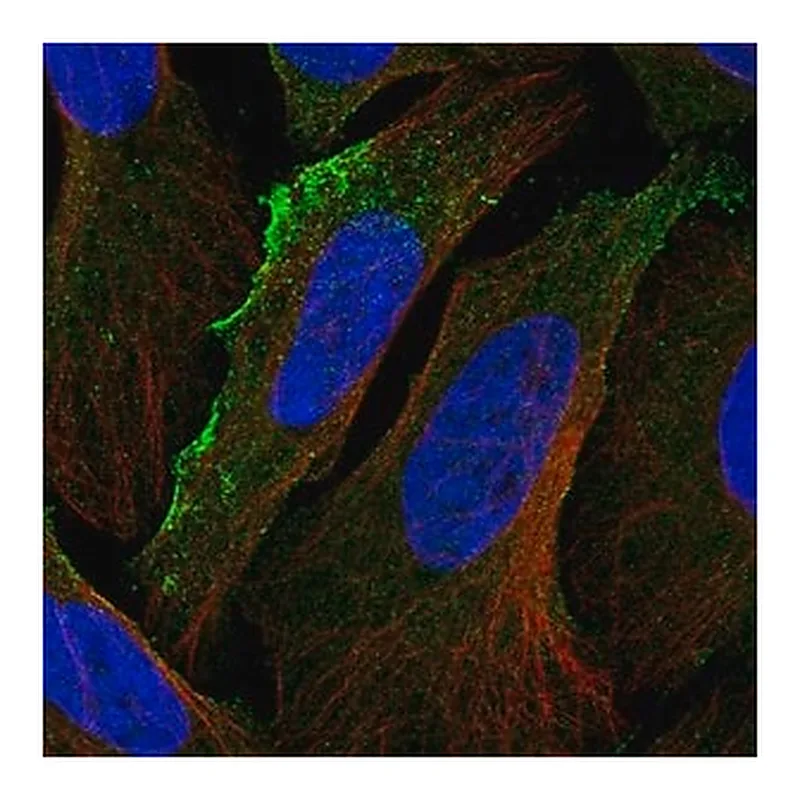 Merck Anti-ACKR3 antibody produced in rabbit