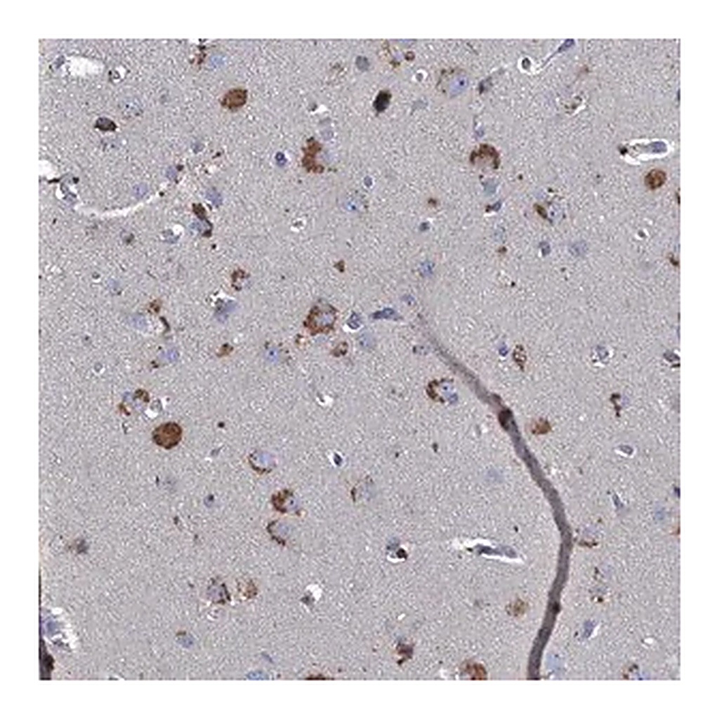 Merck Anti-TMX2 antibody produced in rabbit