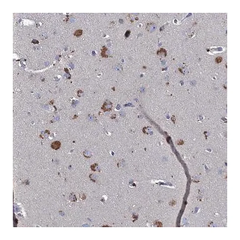 Merck Anti-TMX2 antibody produced in rabbit